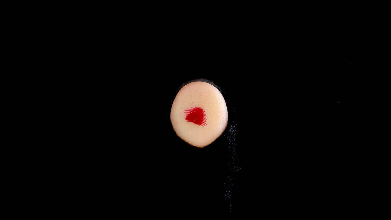 Spider blood