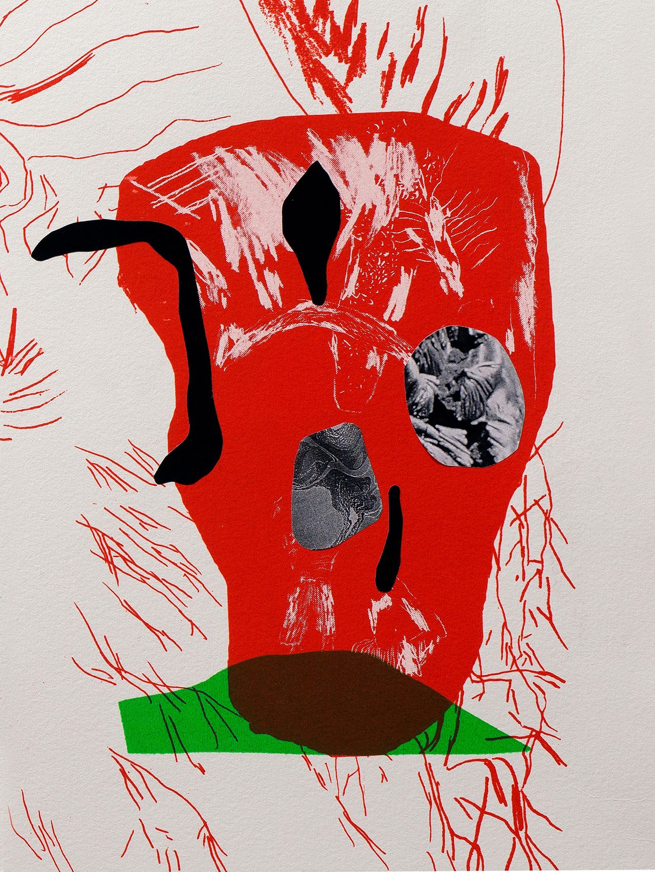 נינו ביניאשוילי, תחלואה כפולה