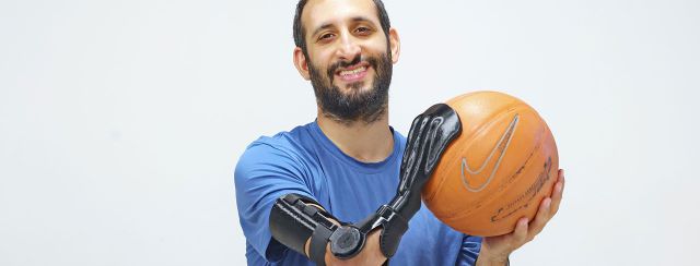 פרוטזה בקוד פתוח. עיצוב: דנה יחיא שווקמן; צילום: Tikun Olam Makers