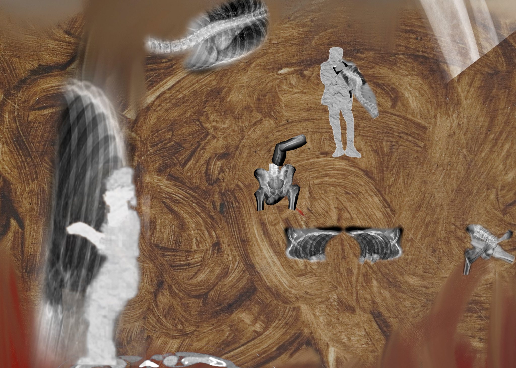 יעל הוניג, קאנון לעצמות